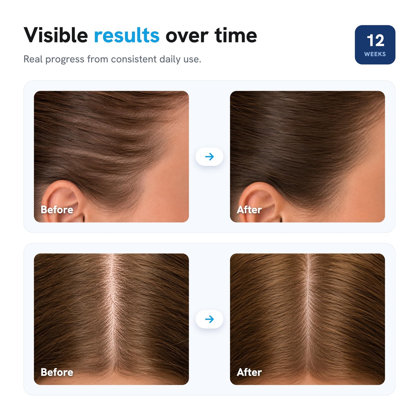 Be Bodywise Hair Growth Serum Roll On